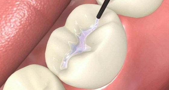 Здоровые зубы - стоматологическая клиника