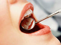 Лечение зубов и виниры в стоматологической клинике «Здоровые зубы»