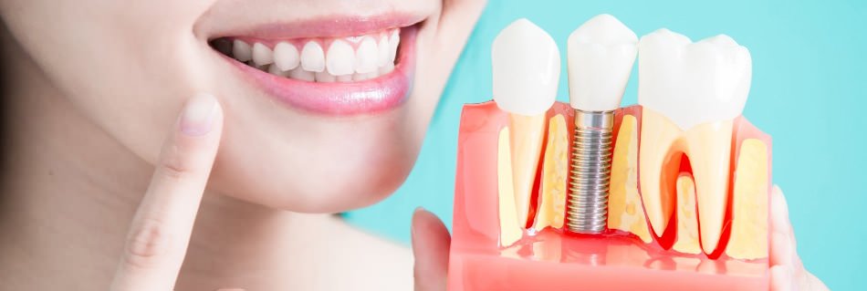 Ответы на все воспросы по показаниям и противопоказаниям к имплантации зубов в стоматологической клинике «Здоровые зубы»