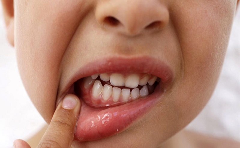 Лечение зубов в детской стоматологии в Хабаровске