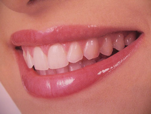 Стоматологическая клиника «Здоровые зубы» в Хабаровске: протезирование зубов, виниры, металлокерамические и циркониевые коронки по выгодным ценам