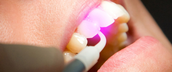Плюсы и минусы лазерного лечения зубов