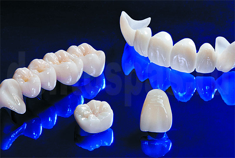 Безметалловые керамические коронки в стоматологической клинике «Здоровые зубы»
