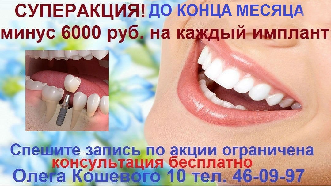 Имплантация зубов в Хабаровске