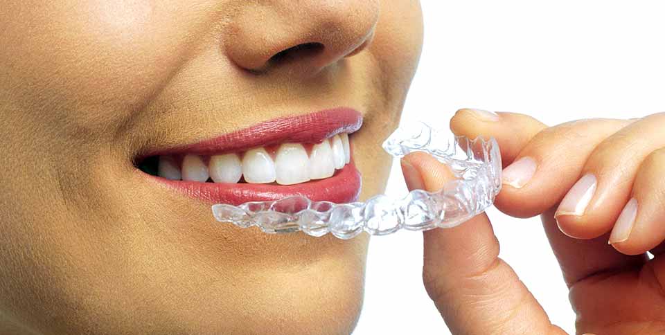 Секреты как отбелить зубы дома в стоматологической клинике «Здоровые зубы»