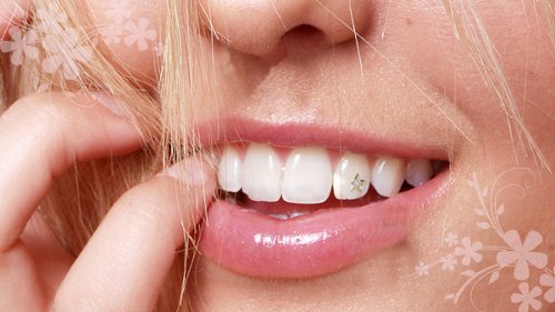 Чистка и отбеливание зубов, брекеты, зубные скайсы и другие услуги стоматолога в стоматологической клинике «Здоровые зубы» в Хабаровске